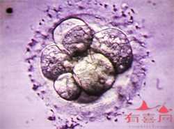 武汉等待供卵要花多少钱，武汉大学中南医院可以做供精试管婴儿吗？附武汉供